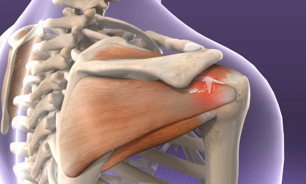 Trauma & fracture surgeon in Bareilly providing expert fracture treatment, accident injury care, surgical management, and complete orthopaedic recovery support.
